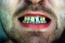 Шабуров "Лечение зубов"
